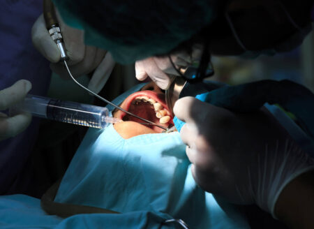 oral-surgery-